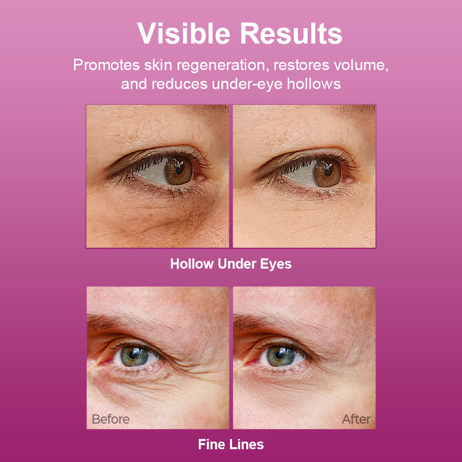 🏆Limited Time Offer🏆 — Calcium Multi-Effect Moisturizing Cream | Anti-Aging, Firming, Wrinkle Removal🔥