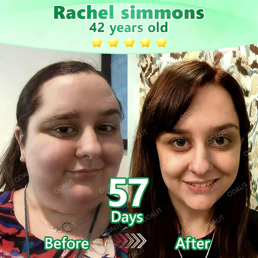 [ 2026 FDA-Registered & Official store] 🇺🇸 ODALIT® L-Carnitine × Retinol | Slimming & Firming 2-in-1 Nano Microneedle Patch 🔥 Obesity, Diabetes, Sleep Apnea, And Joint Issues⏳