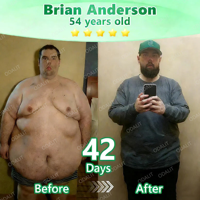 [ 2026 FDA-Registered & Official store] 🇺🇸 ODALIT® L-Carnitine × Retinol | Slimming & Firming 2-in-1 Nano Microneedle Patch 🔥 Obesity, Diabetes, Sleep Apnea, And Joint Issues⏳