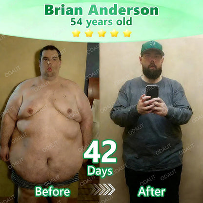 [ 2026 FDA-Registered & Official store] 🇺🇸 ODALIT® L-Carnitine × Retinol | Slimming & Firming 2-in-1 Nano Microneedle Patch 🔥 Obesity, Diabetes, Sleep Apnea, And Joint Issues⏳