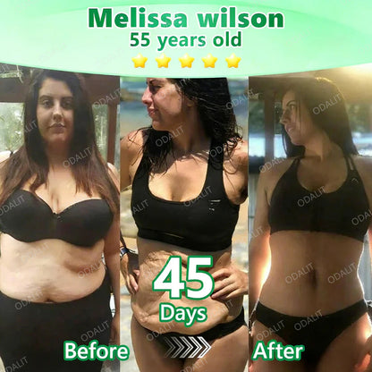 [ 2026 FDA-Registered & Official store] 🇺🇸 ODALIT® L-Carnitine × Retinol | Slimming & Firming 2-in-1 Nano Microneedle Patch 🔥 Obesity, Diabetes, Sleep Apnea, And Joint Issues⏳