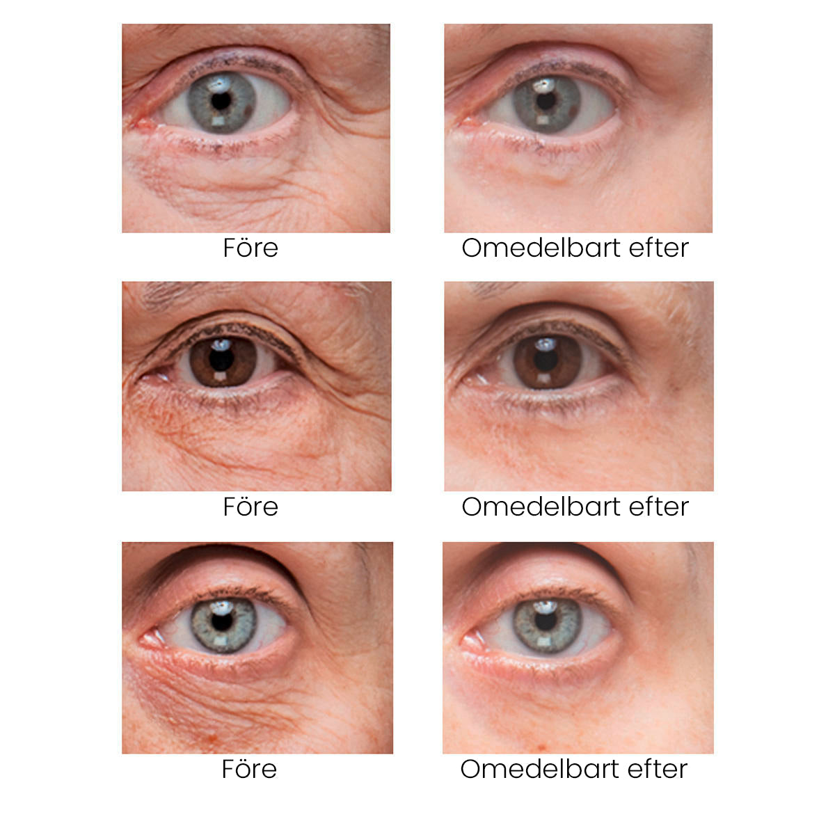 🔥Instant Firm Eye Tightening Cream- Eliminates eye bags & wrinkles 👁✨