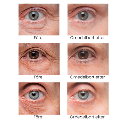 🔥Instant Firm Eye Tightening Cream- Eliminates eye bags & wrinkles 👁✨