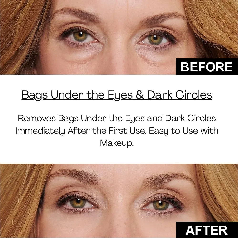 🔥Instant Firm Eye Tightening Cream- Eliminates eye bags & wrinkles 👁✨