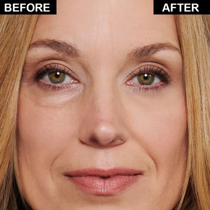 🔥Instant Firm Eye Tightening Cream- Eliminates eye bags & wrinkles 👁✨