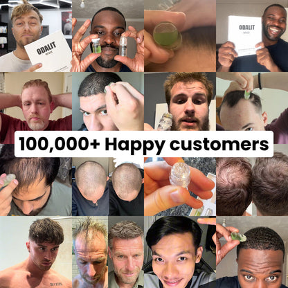 ODALIT™ Hair Regrowth System | Real Results for Thicker, Fuller Hair—Clinically Backed Serum That Works