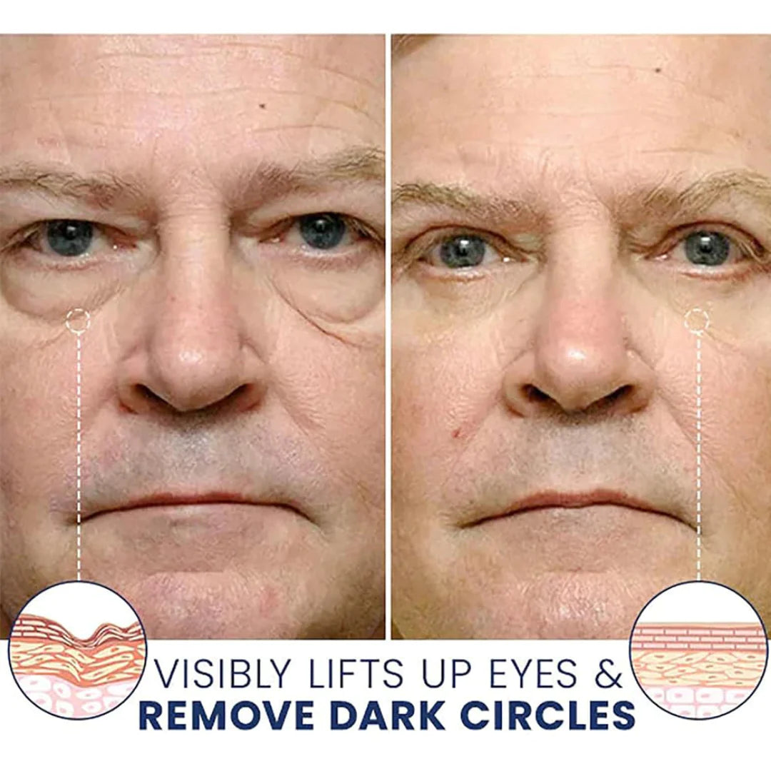 🔥Instant Firm Eye Tightening Cream- Eliminates eye bags & wrinkles 👁✨