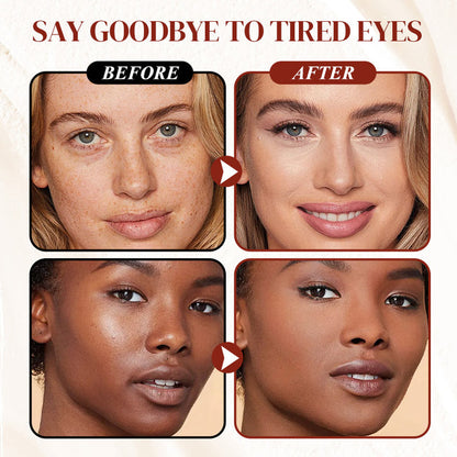 ⏰ Limited Stock! 50% OFF :"Radiant Awake" Under-Eye Color Corrector + Free Brush | Bright, Crease-Free Dark Circle Defense 🎀