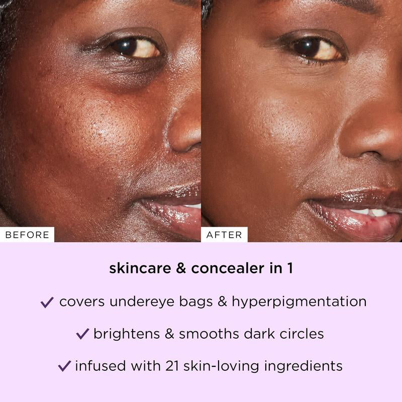 💝Last 4 hours 70% off! Cover, Hydrate & Glow: Meet the Concealer That Does It All.