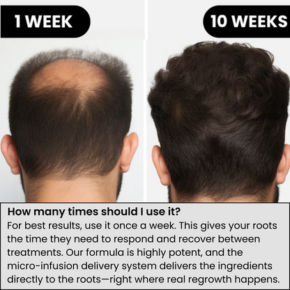 ODALIT™ Hair Regrowth System | Real Results for Thicker, Fuller Hair—Clinically Backed Serum That Works